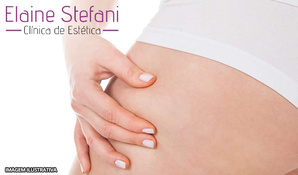 Curso de Micropuntura Elétrica na Clinica de Estética Elaine Stefani