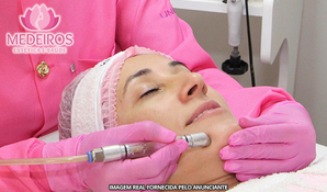 Limpeza de pele com peeling de diamante + designer de sobrancelhas e depilação egípcia no buço, na Medeiros Estética e Saúde em Laguna