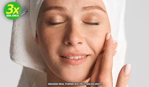 ESTÉTICA AVANÇADA SÔNIA GARCIA: 1 sessão de peeling black peel, o famoso peeling de Hollywood